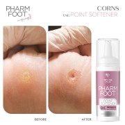 Point Softener 15ml Point Softener 15ml