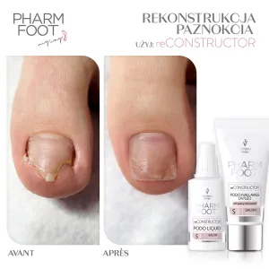 Podo Nail Set UV/LED - reConstructor Podo Nail Set UV/LED - reConstructor